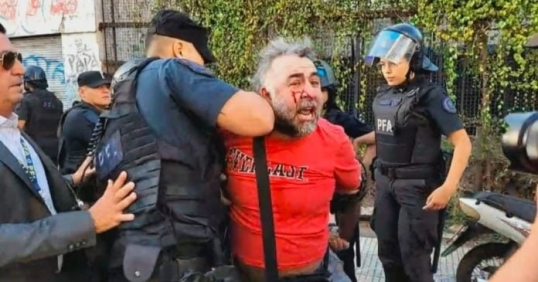 APeRA repudia el salvaje ataque policial contra un trabajador de prensa